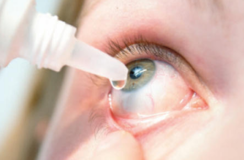 العين التهاب ملتحمة التهاب الملتحمة:
